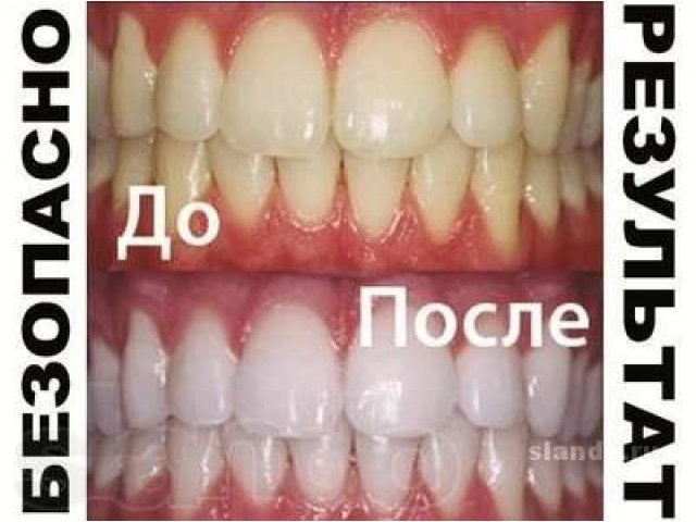 Отбеливание зубов в городе Саяногорск, фото 3, Средства по уходу