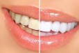 Отбеливатель для зубов White Light в городе Самара, фото 2, телефон продавца: +7 (987) 445-66-19