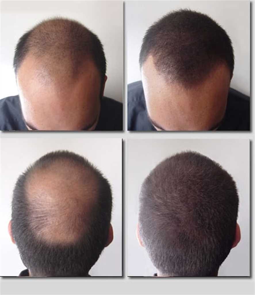 Средство от выпадения волос в городе Москва, фото 2, телефон продавца: +7 (967) 099-94-74
